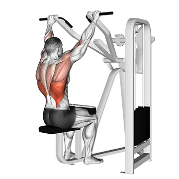Lever Front Pulldown - Exclusive get you ultimate Strength for Latissimus Dorsi from X health blend   Animated Exercise  Library